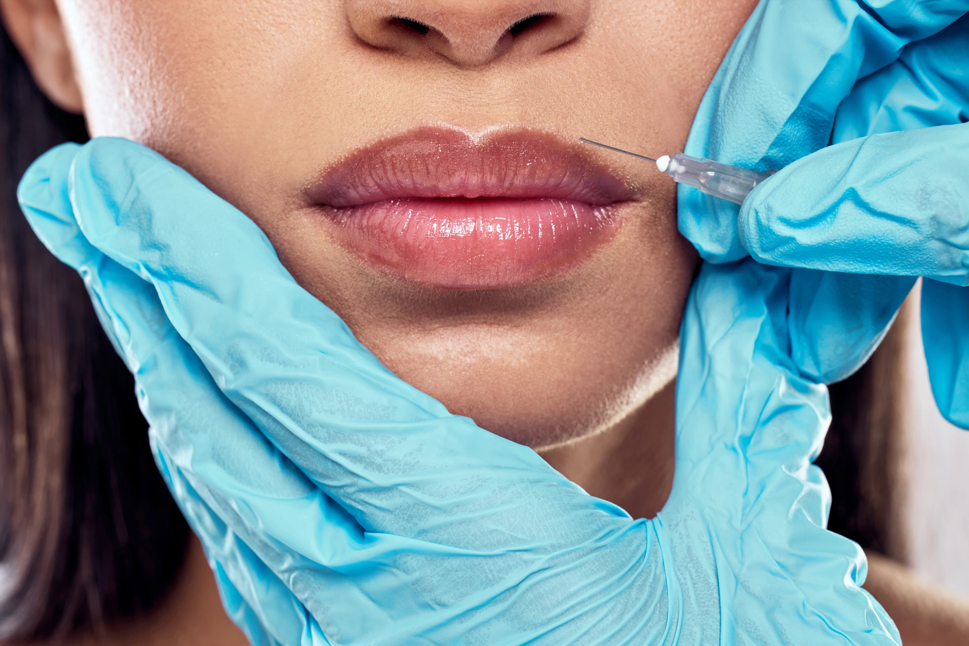 shot-of-a-woman-having-her-lips-injected-with-fill-2023-11-27-05-10-44-utc