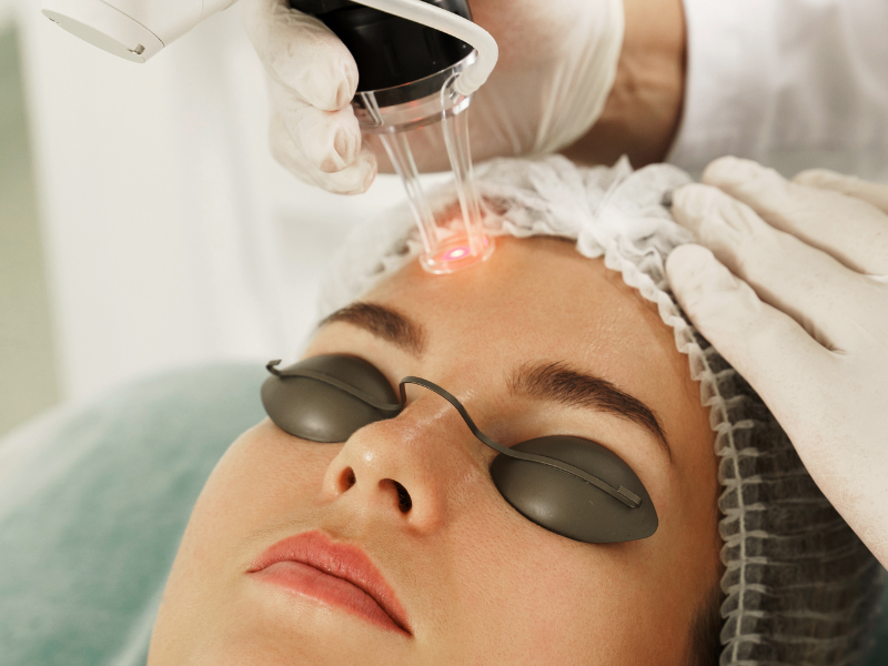 non-surgical Laser Dark Spot Removal