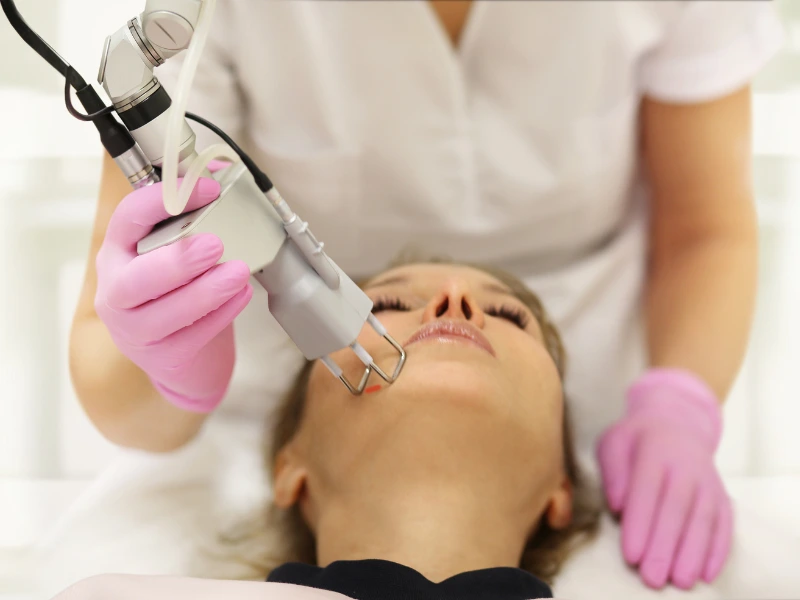 Laser Dark Spot Removal
