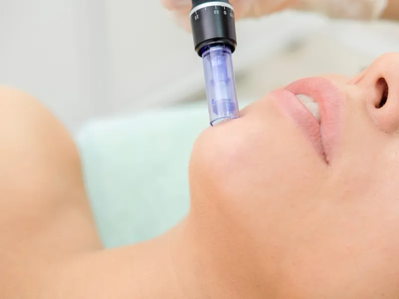 exosome skin treatment process