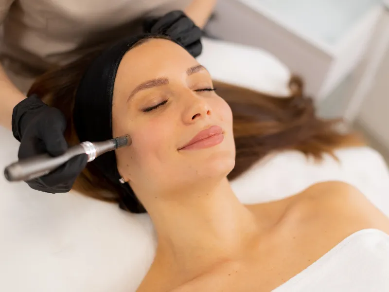 types of microneedling