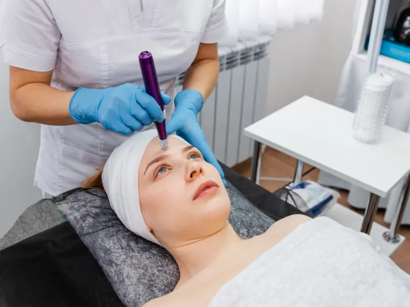 what is microneedling?