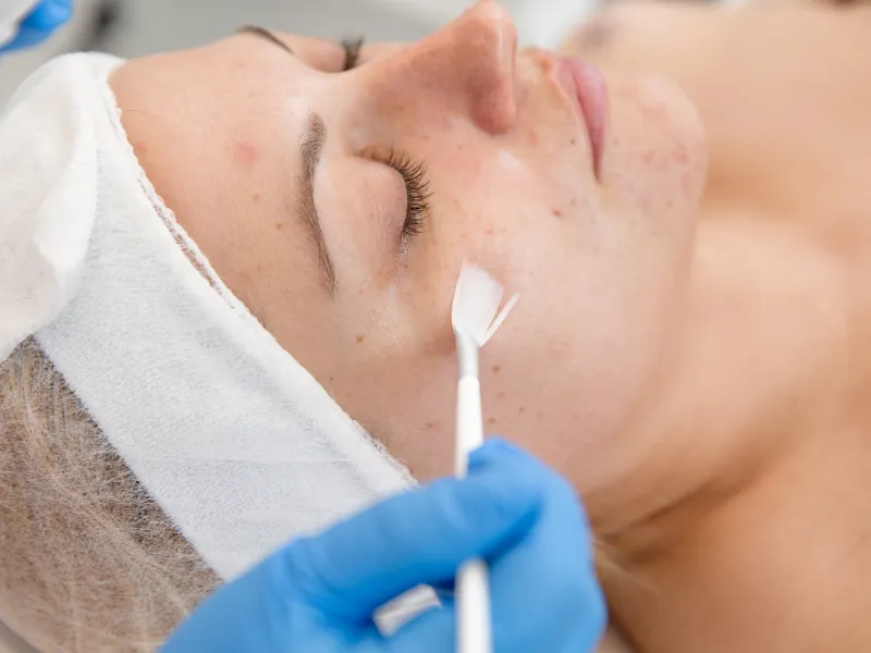 scar treatment in Irvine & Lake Forest, CA