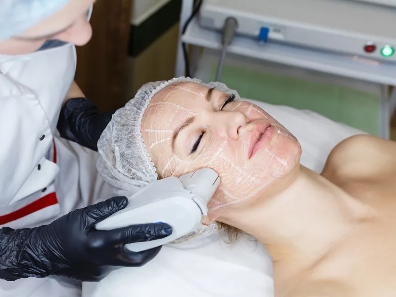 ultherapy-in-lake-forest-california