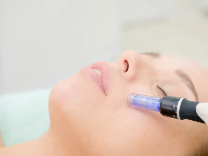 what is scar treatment?