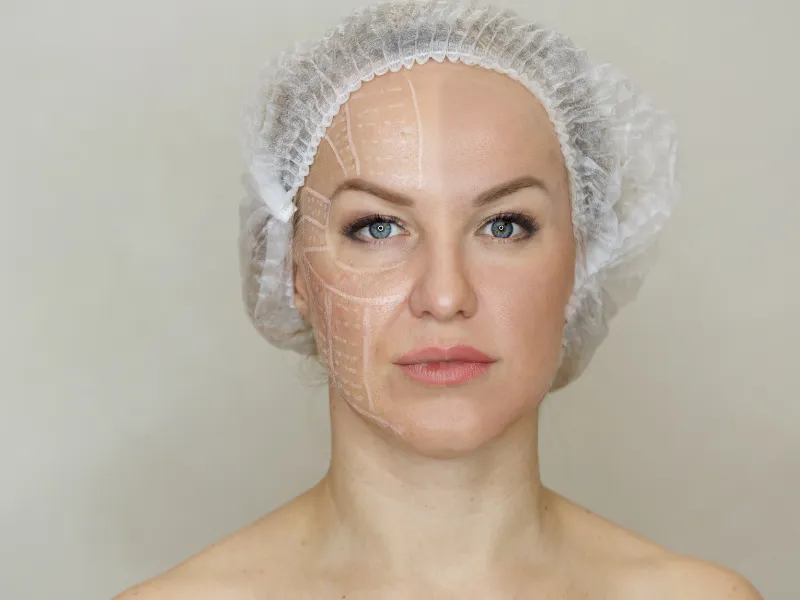 what is ultherapy treatment