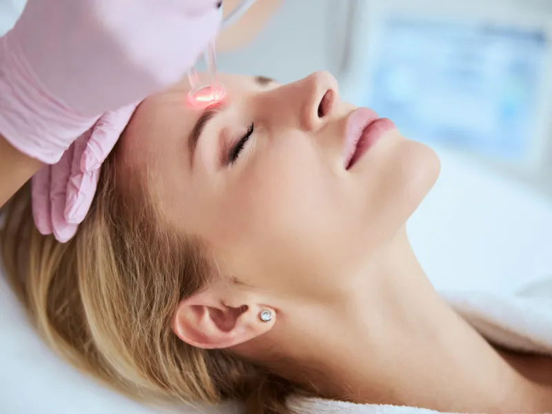 laser skin resurfacing in lake forest ca