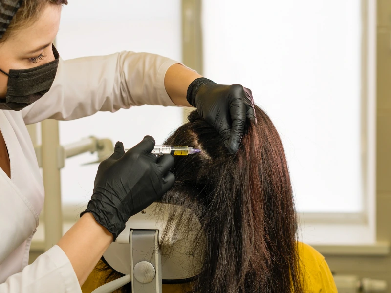 prp hair treatment results