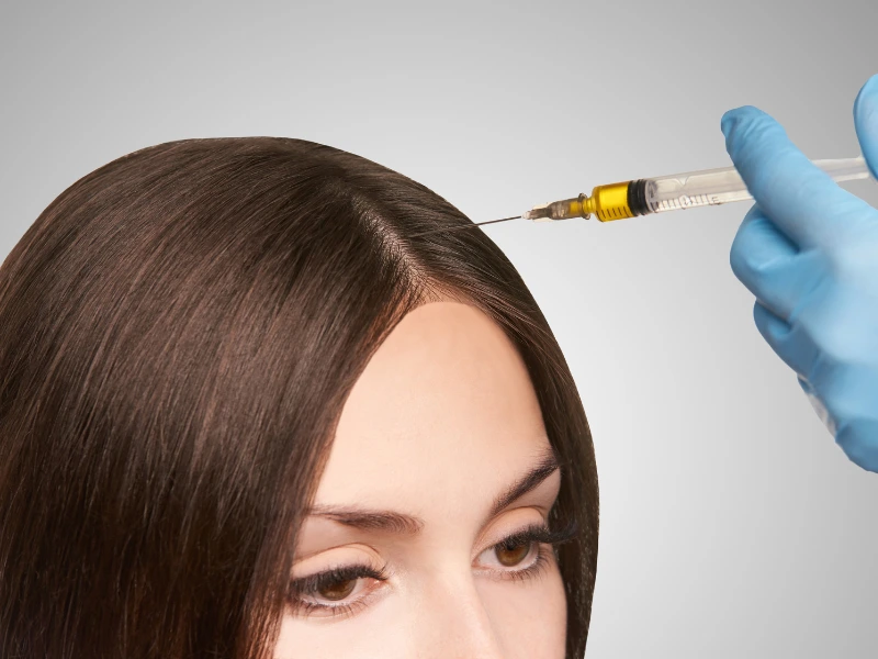 prp injection for hair loss