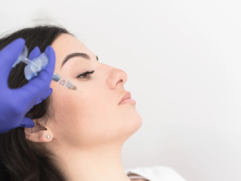 restylane refyne treatment procedure