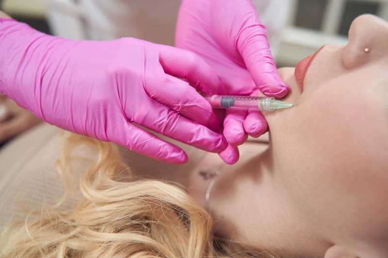 revanesse versa filler