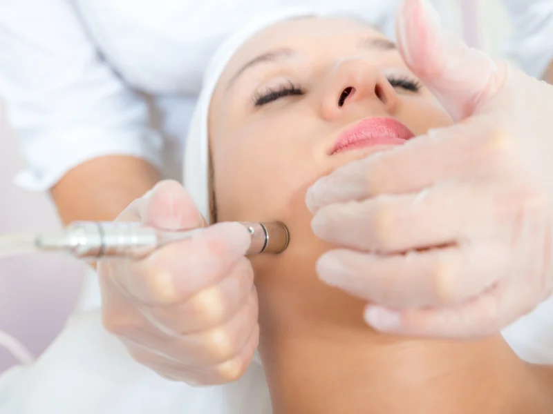 microdermabrasion or hydrafacial