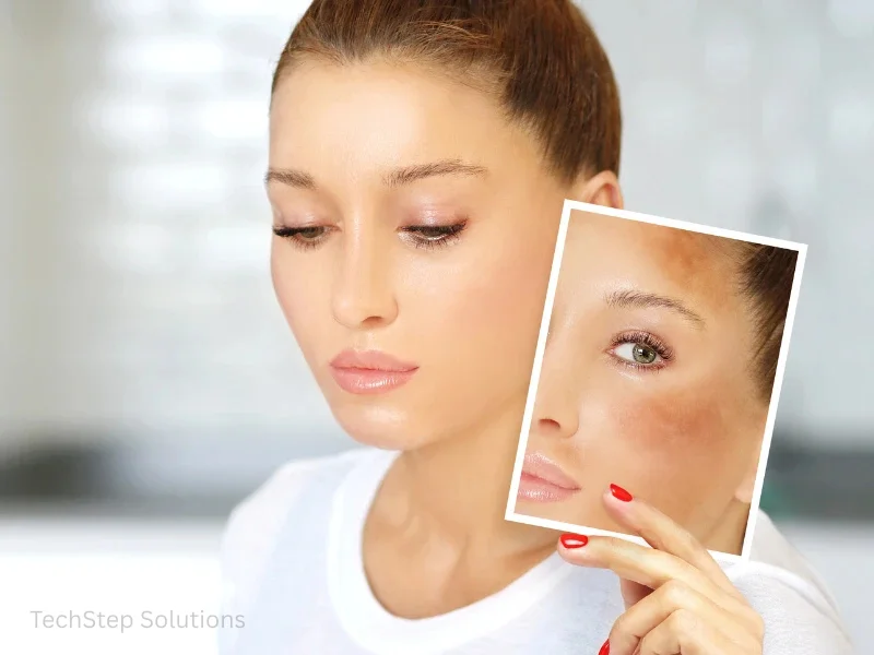 dark spot laser removal benefits