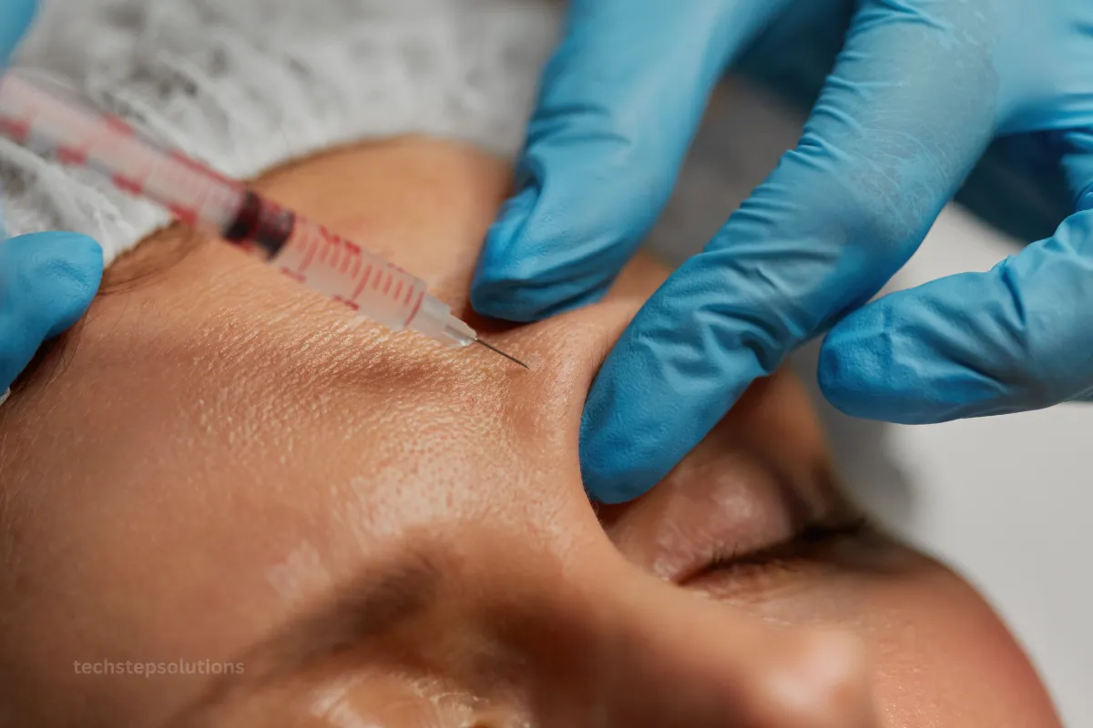 dermal filler injections Irvine