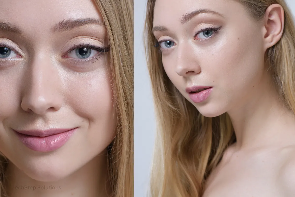 dermal fillers before after