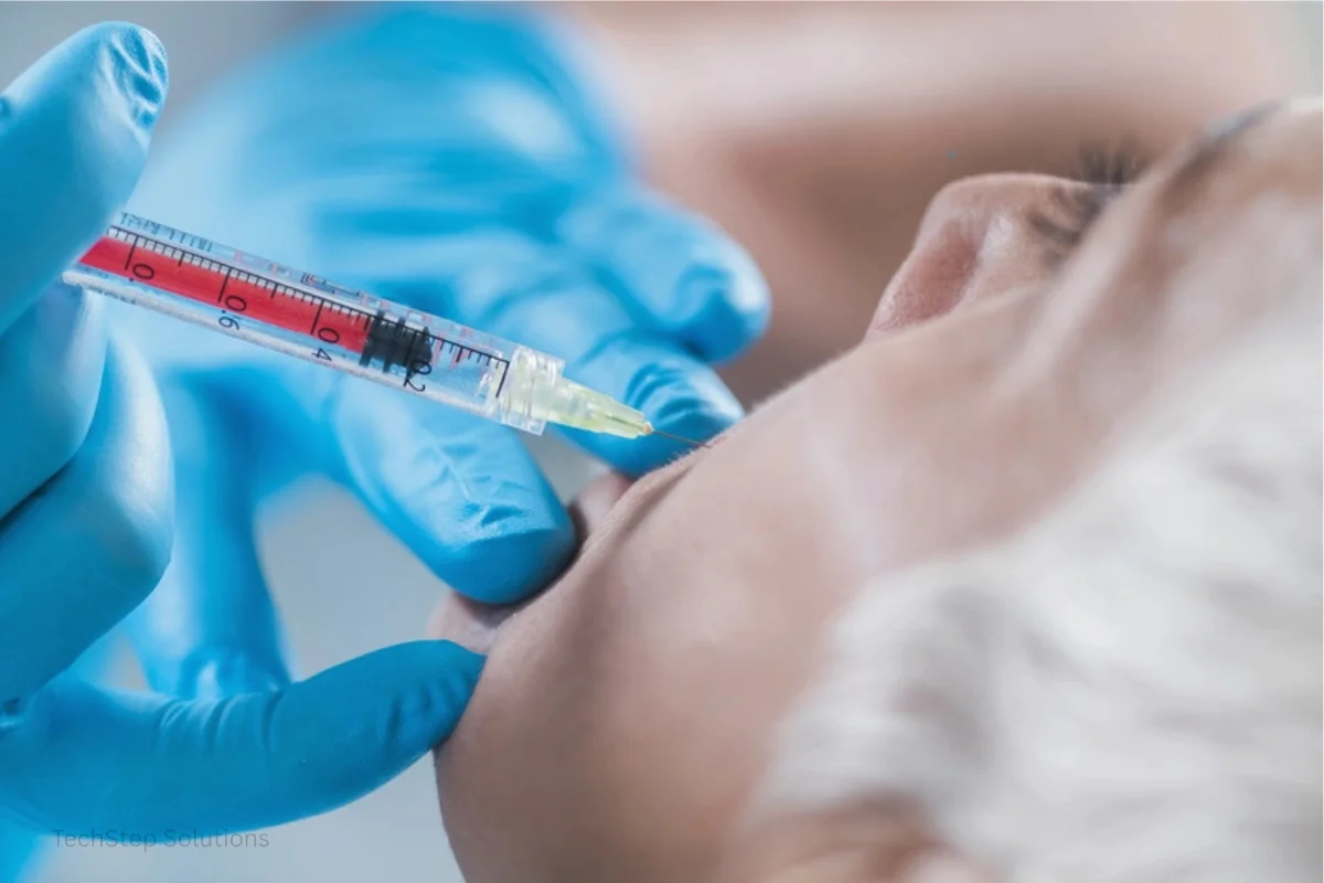 ellanse treatment