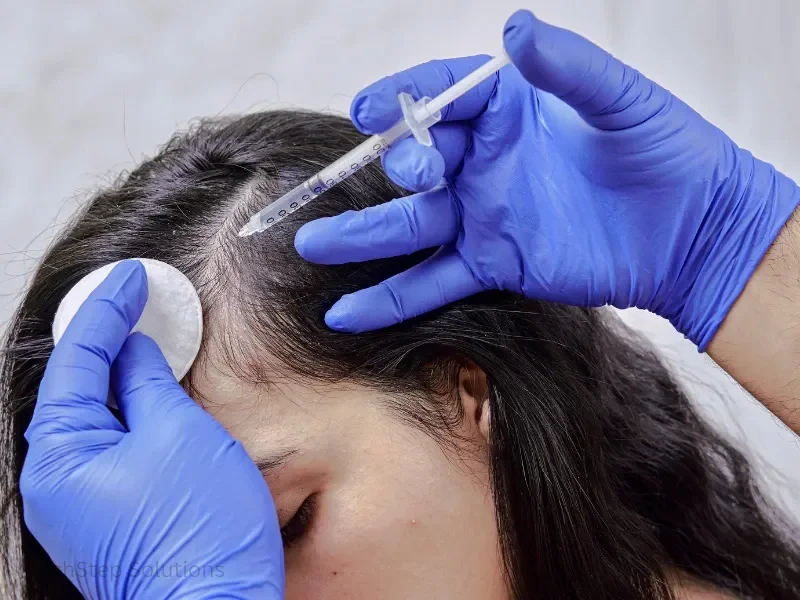 exosome hair therapy procedure