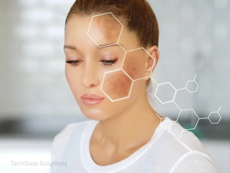 laser-dark spot removal cost