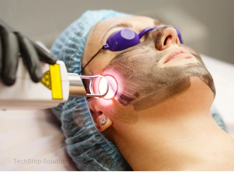 laser therapy for dark spots