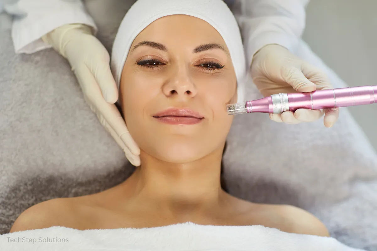 microneedling before after