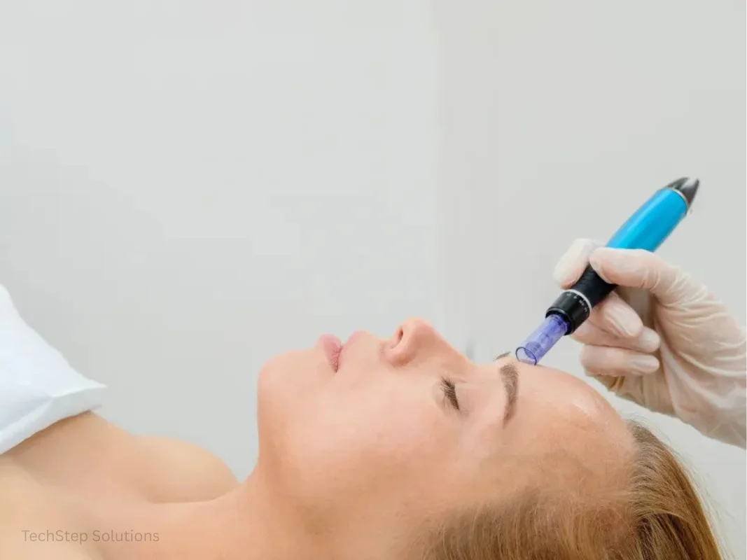 microneedling benefits