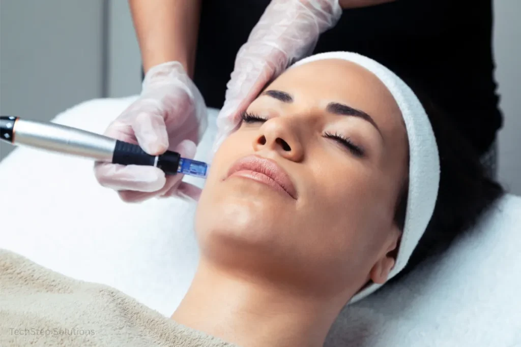 microneedling irvine​