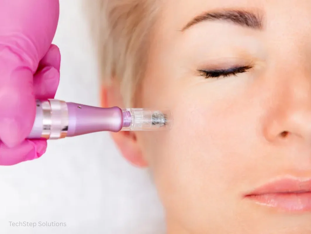 microneedling treatment in irvine and lake forest ca