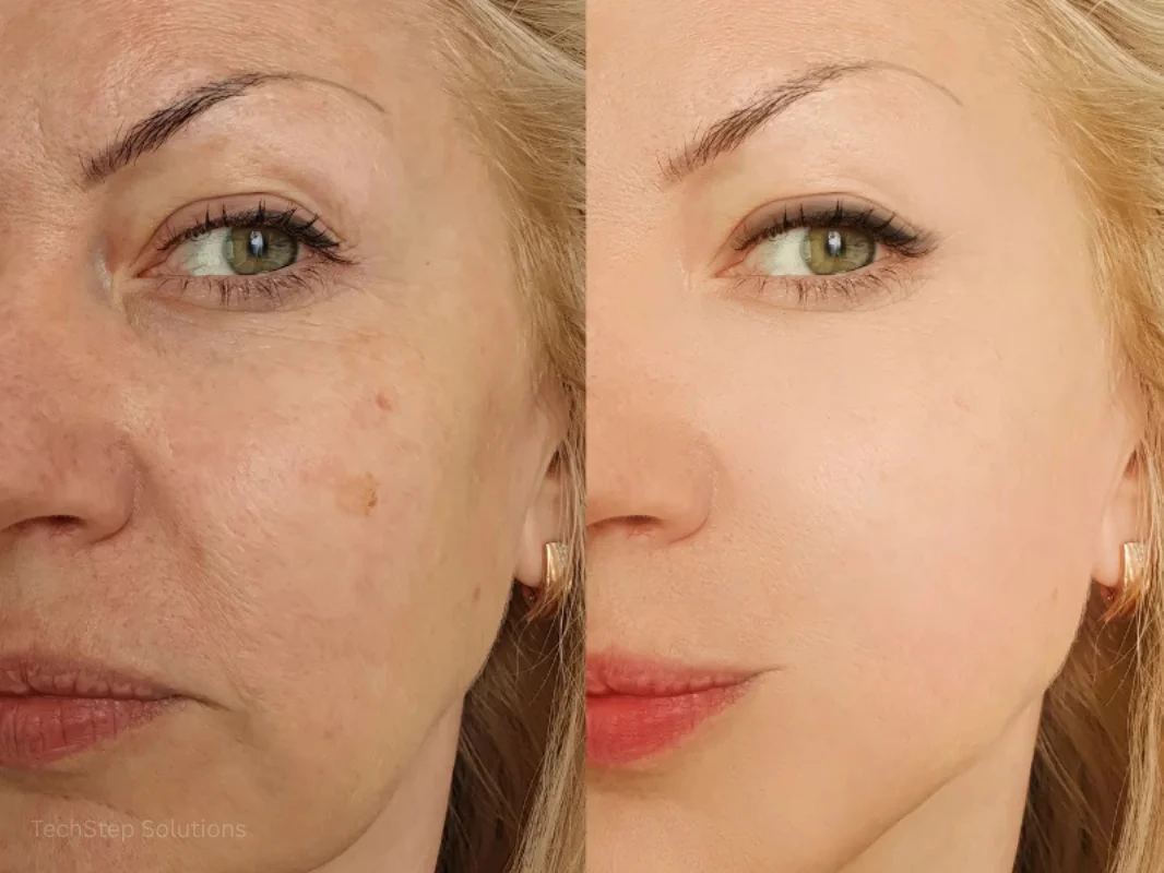 oligio treatments we offer for firmer smoother skin