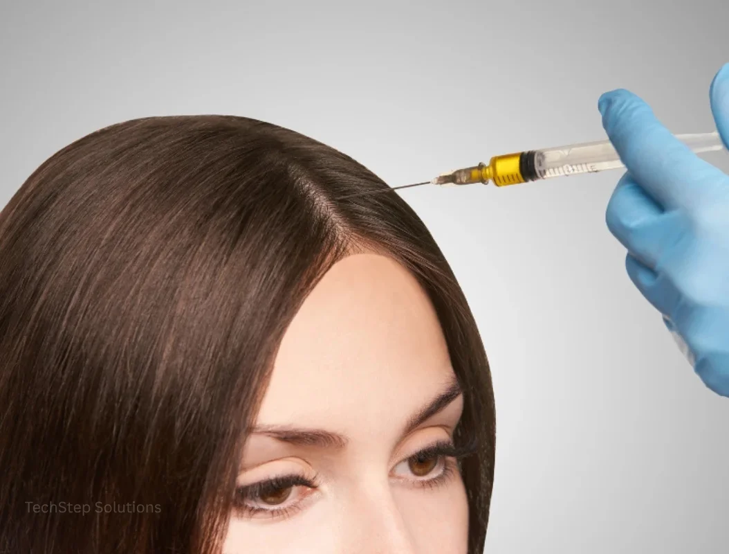 prp injection for hair loss