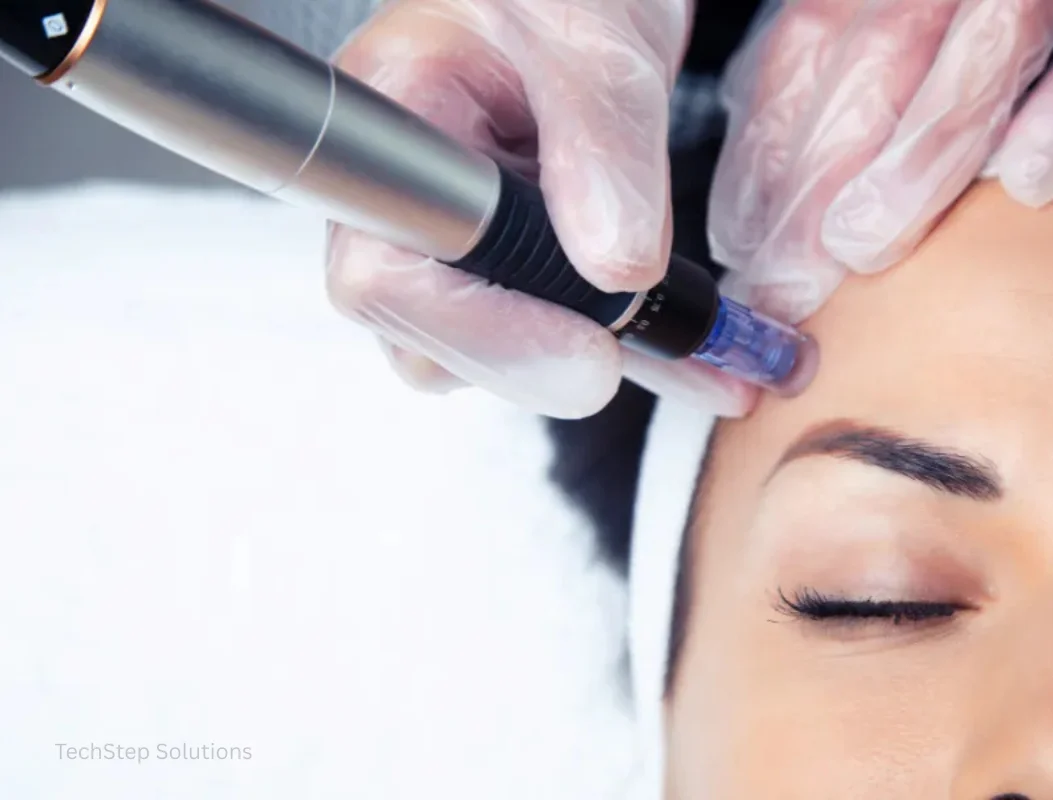 prp microneedling before and after
