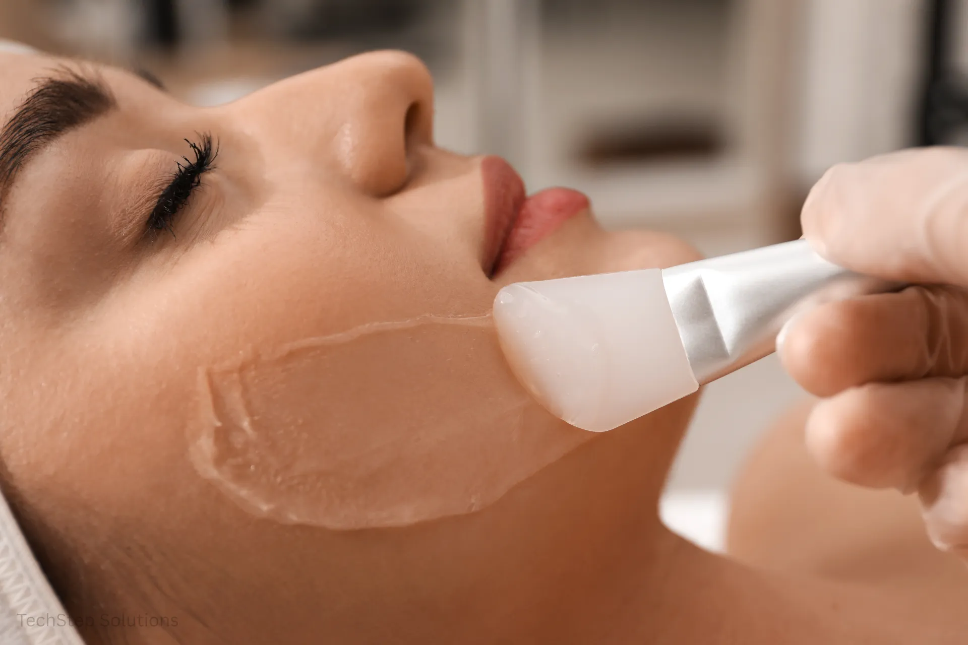 how much does a chemical peel cost