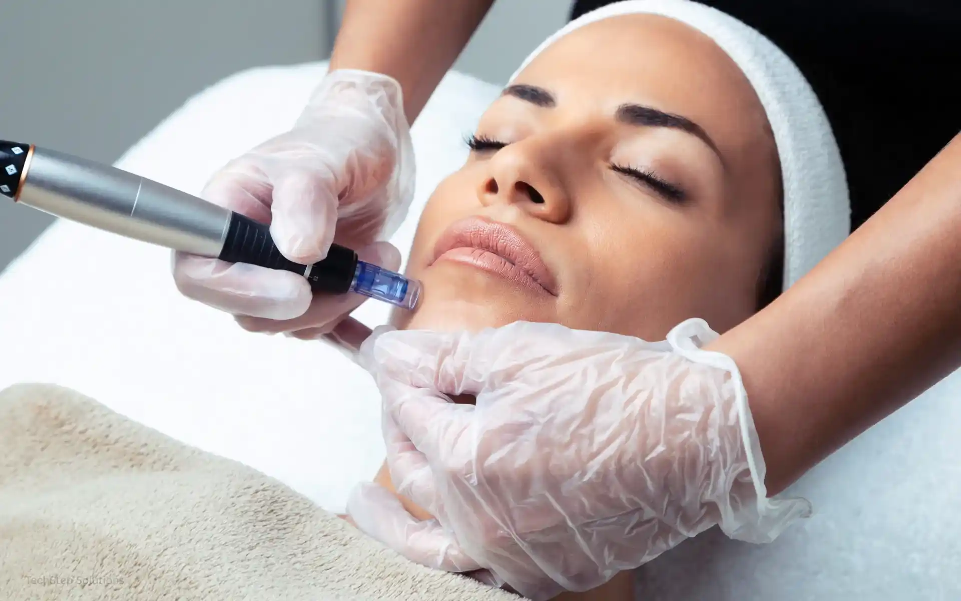 microneedling orange county ca