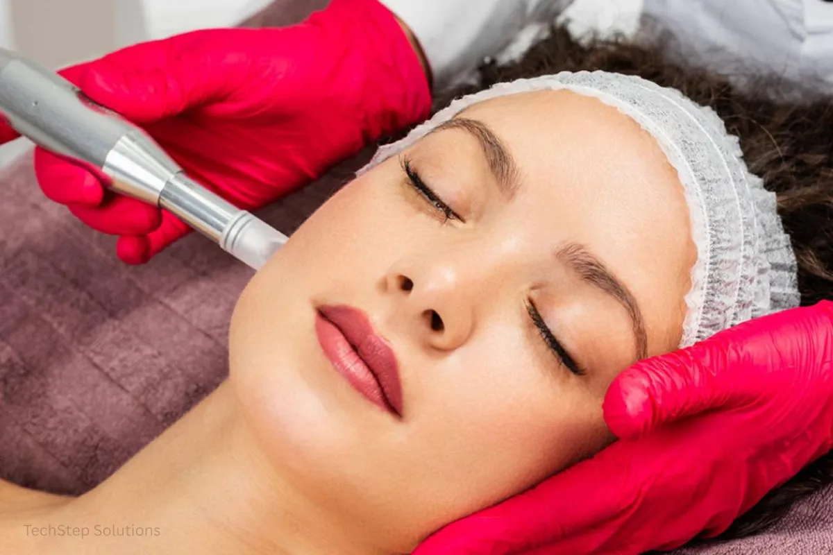microneedling orange county california