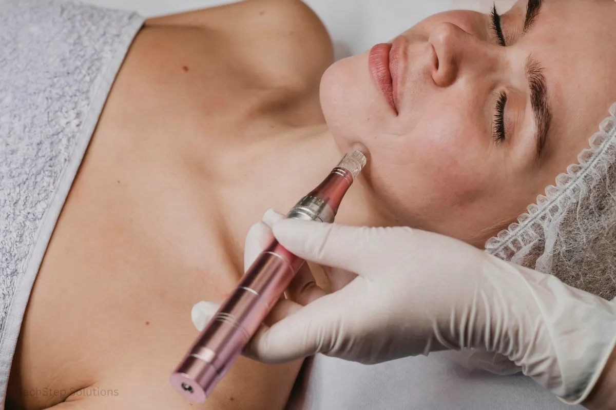 microneedling orange county