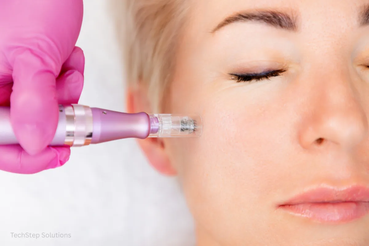 what is microneedling