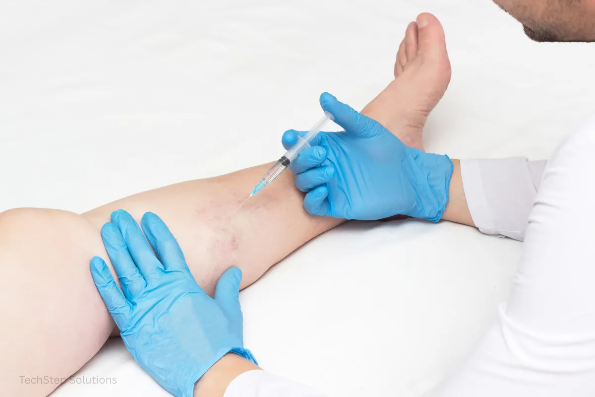 what is sclerotherapy treatment
