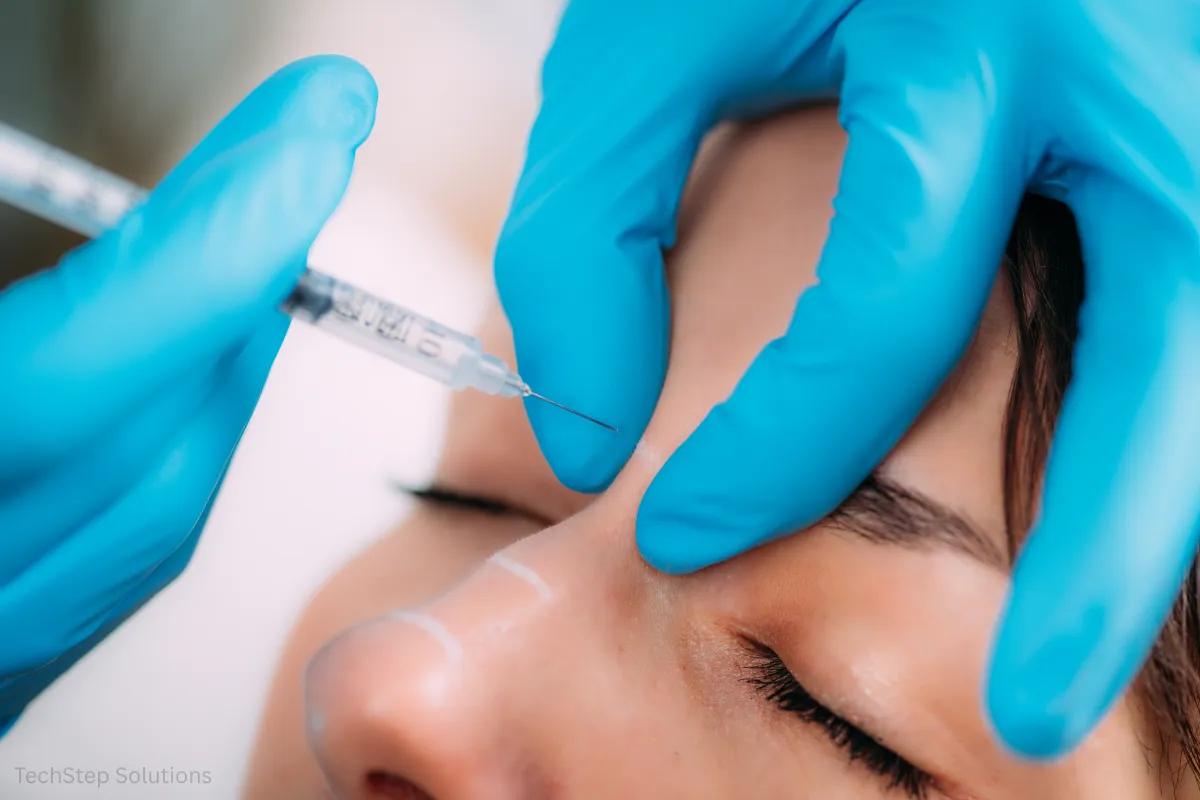 how dermal fillers work