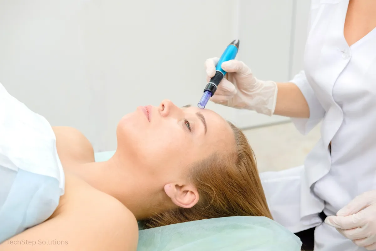 microneedling option