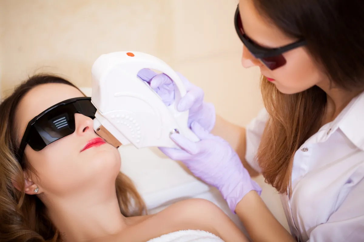 nordlys laser before and after