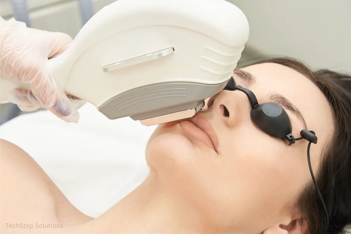 sun damage laser treatment