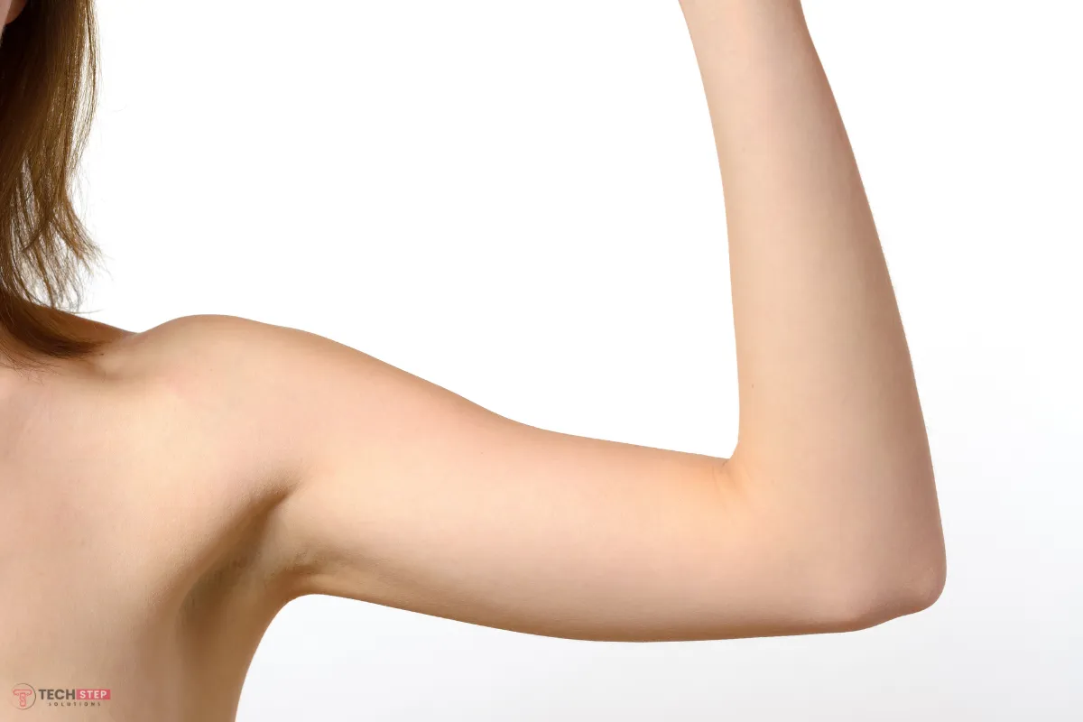 Elbow Bleaching and Whitening