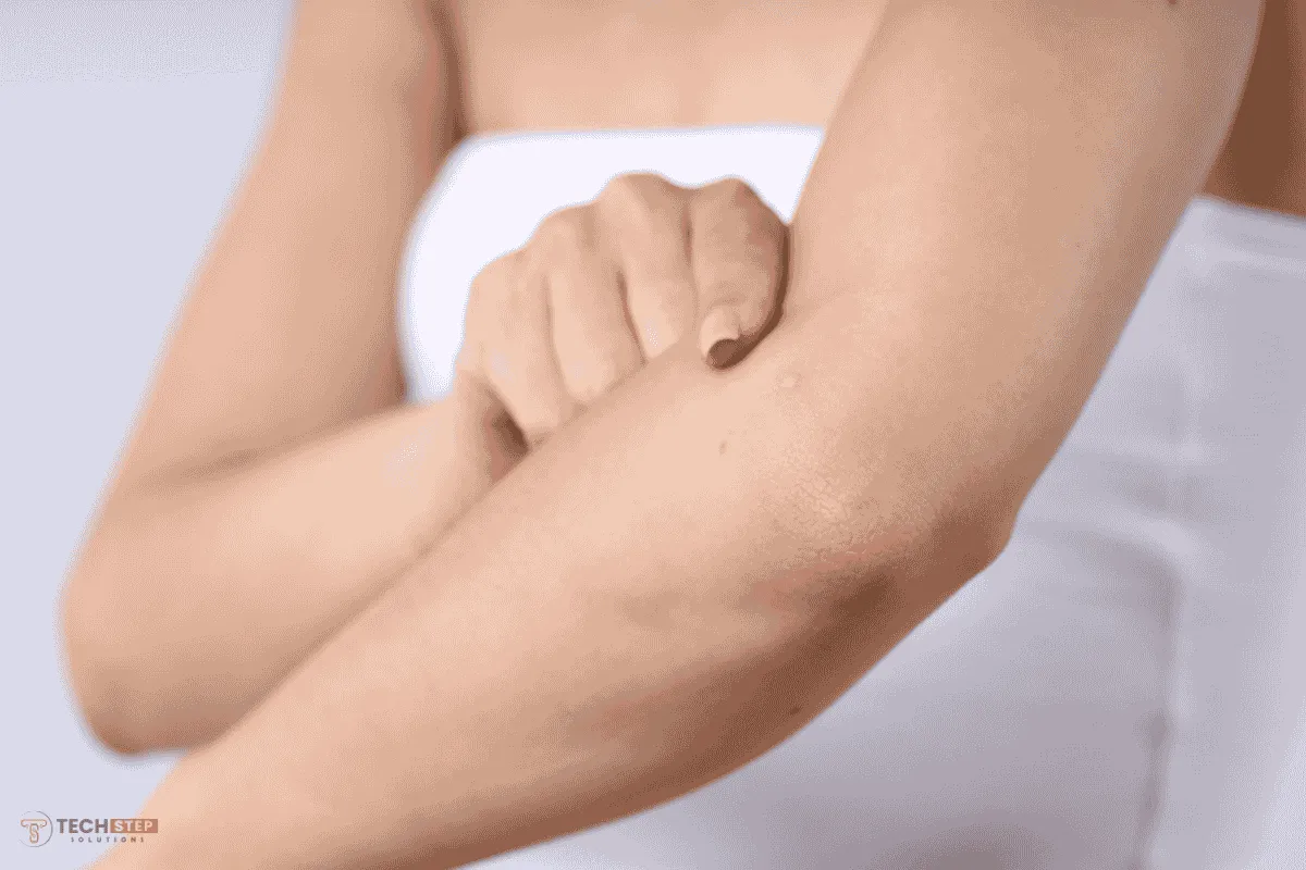 Elbows Bleaching and Whitening Irvine