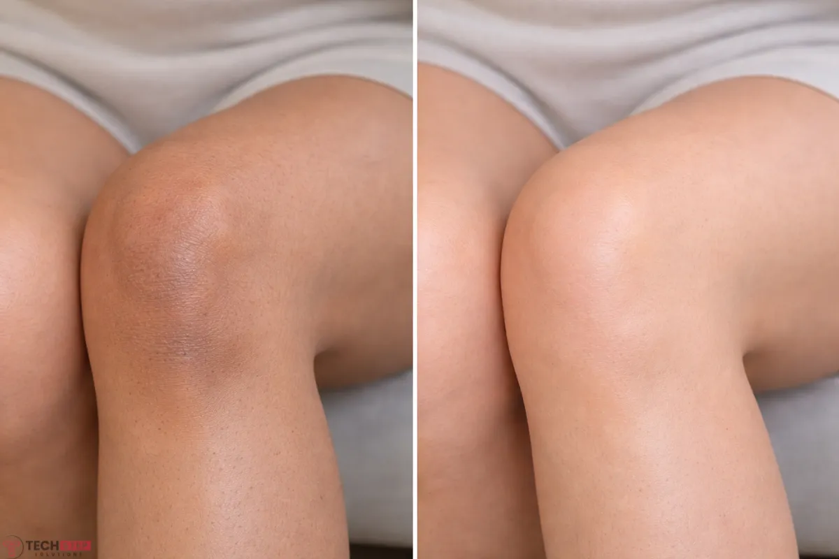 knee bleaching before after