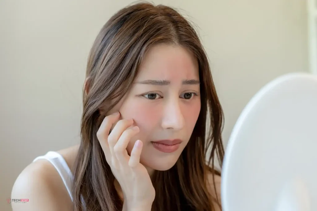 Laser Treatment for Acne Rosacea