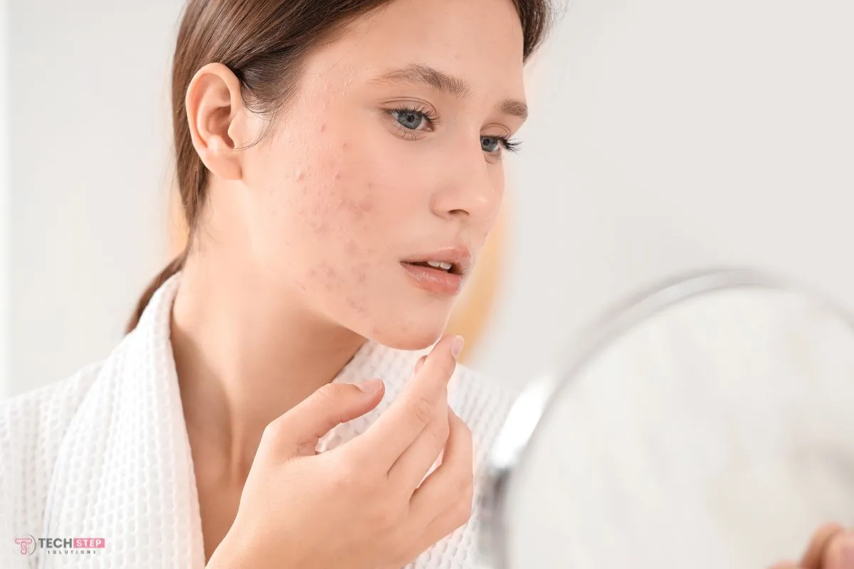 Maintain Clear, Acne-Free Skin with Simple Habits Skincare Tips from AquaVita Wellness & MedSpa
