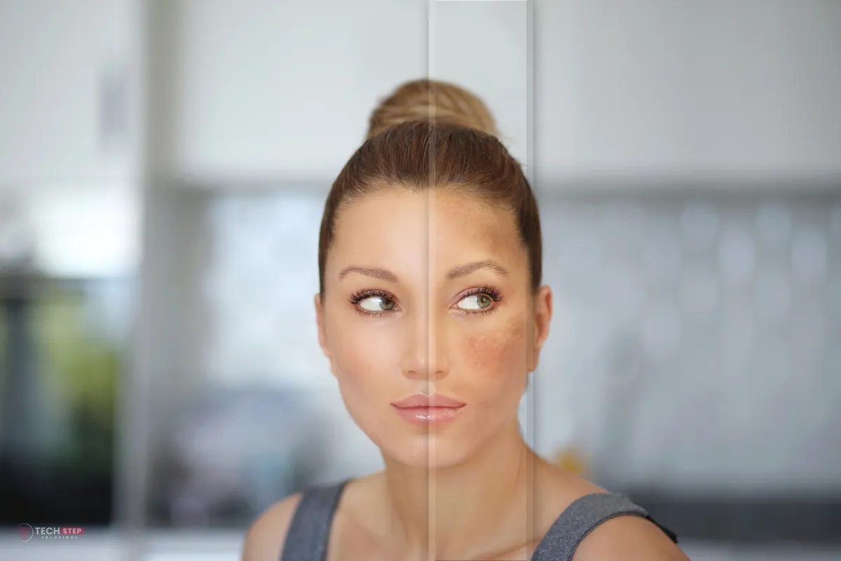 Root Causes of Pigmentation Irvine