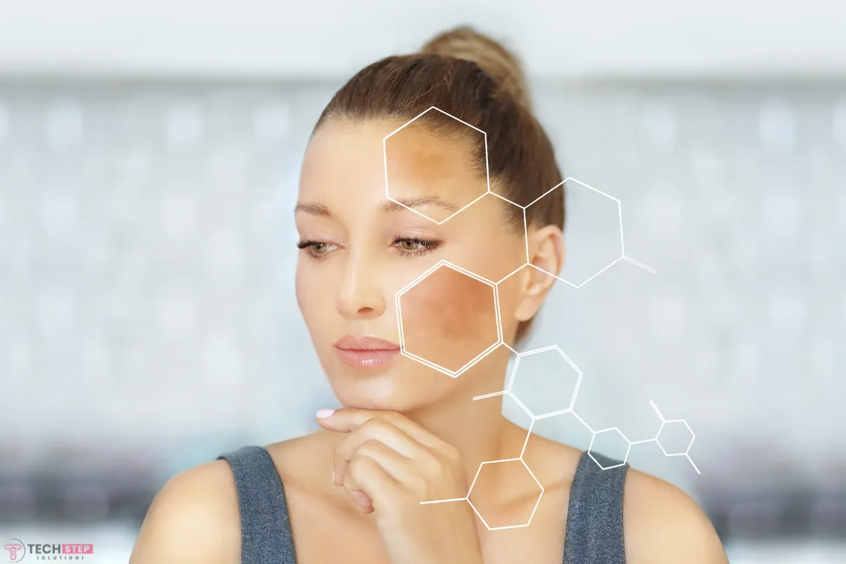 hyperpigmentation scars
