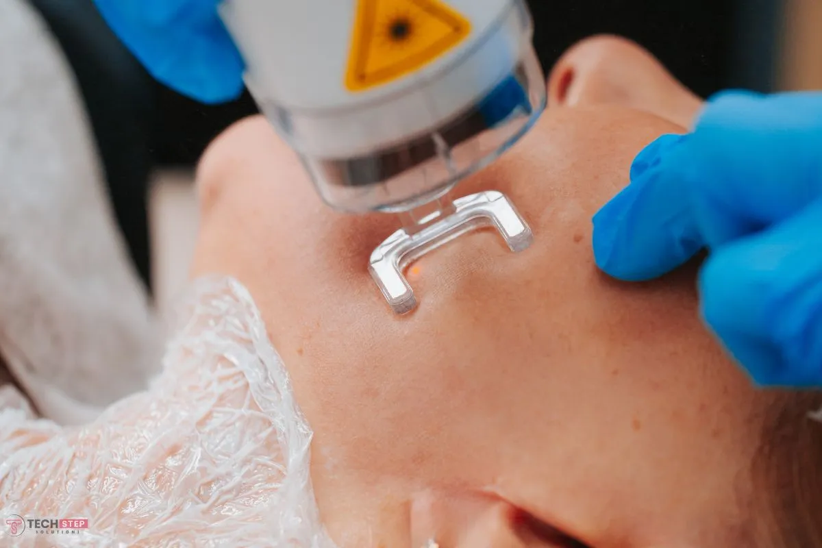 laser skin resurfacing cost orange County