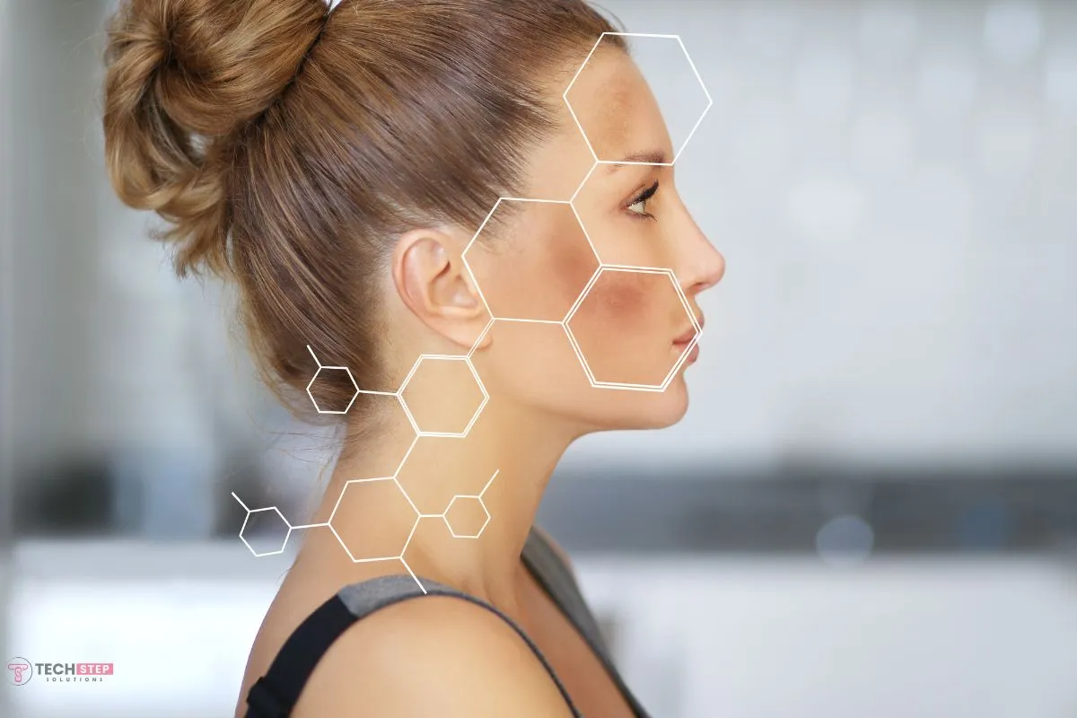 sign of melasma