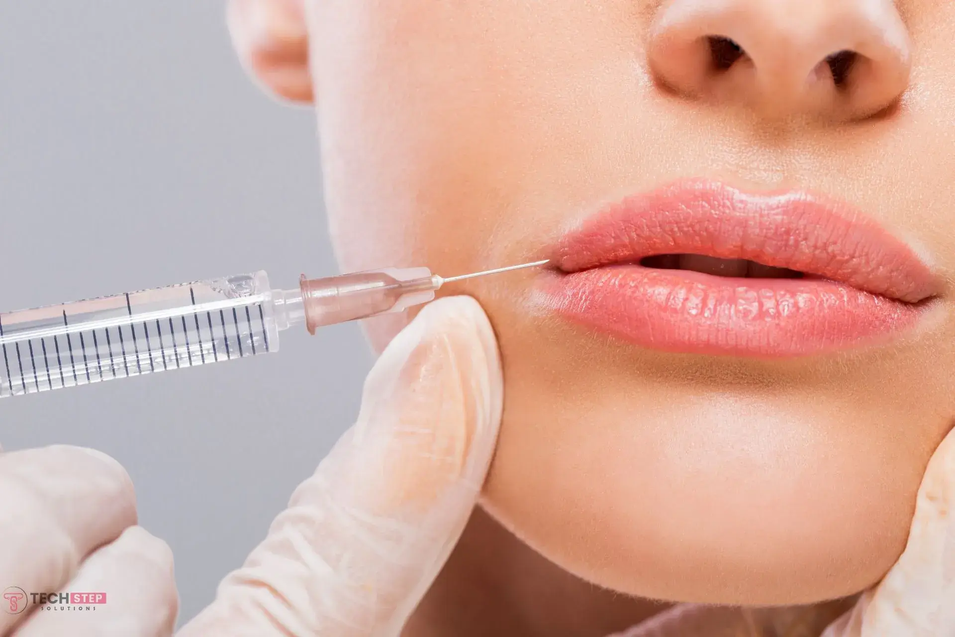 how many units of botox for lip flip 4 to 8 units before after